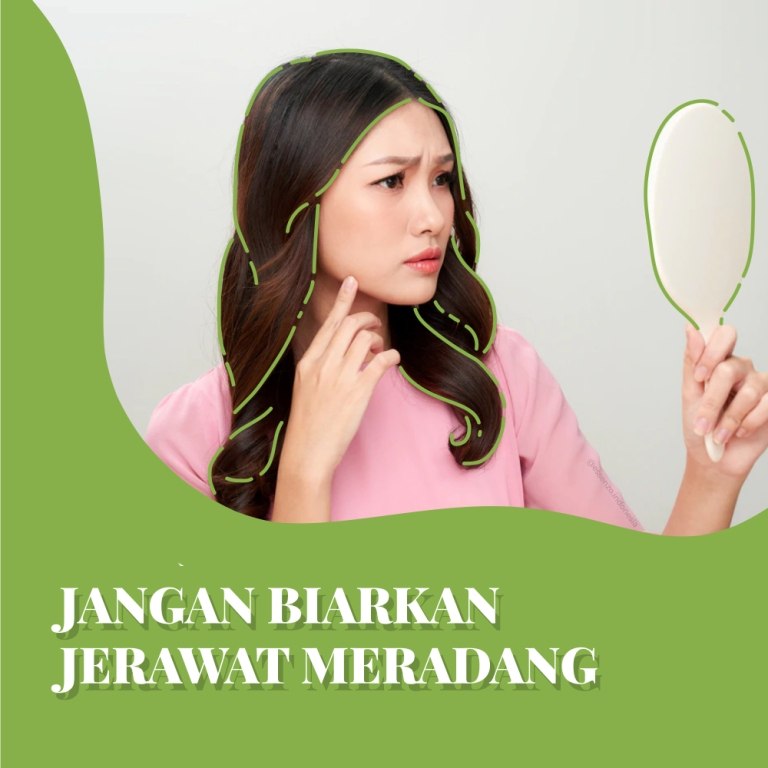 Solusi Hilangkan Masalah&nbsp;Jerawat